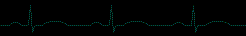 EKG.gif (7461 bytes)